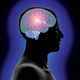 Image for article titled Brain Implants Instead of Prozac
